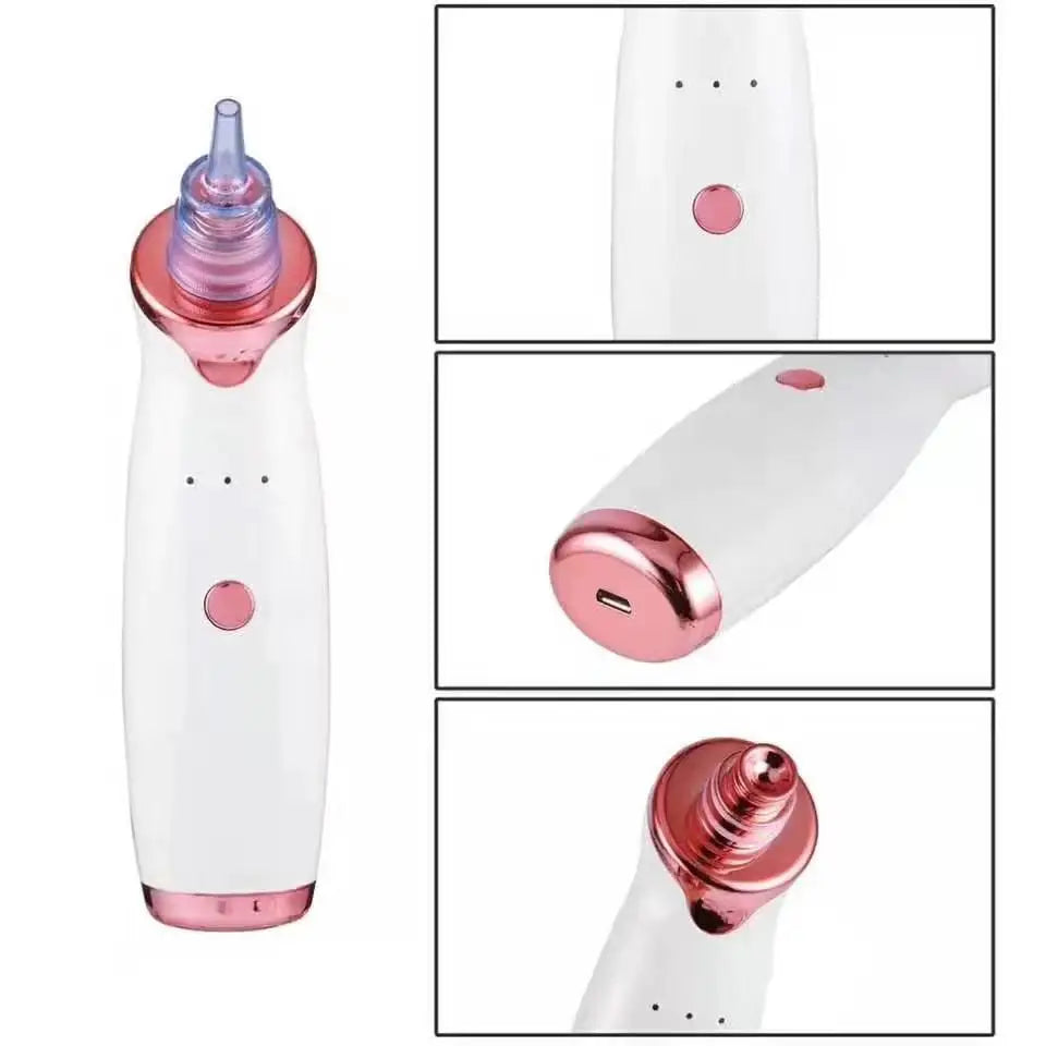 GLAMIXIR ClearSkin™ – Aspirateur Points Noirs Professionnel à Aspiration Douce